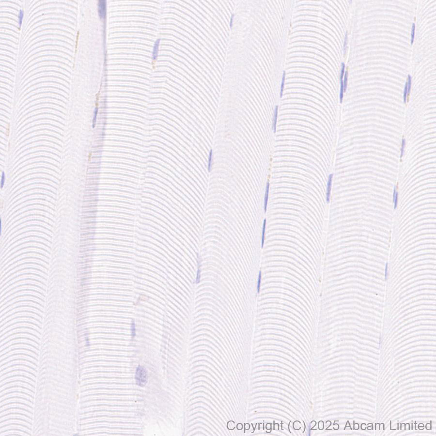 Immunohistochemistry (Formalin/PFA-fixed paraffin-embedded sections) - Rabbit specific IHC polymer detection kit HRP/DAB (ab209101), expandable thumbnail