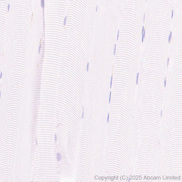 Immunohistochemistry (Formalin/PFA-fixed paraffin-embedded sections) - Rabbit specific IHC polymer detection kit HRP/DAB (AB209101)