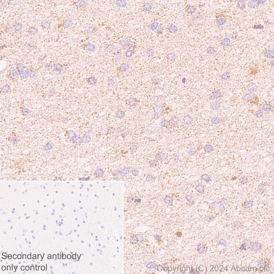 Immunohistochemistry (Formalin/PFA-fixed paraffin-embedded sections) - Rabbit specific IHC polymer detection kit HRP/DAB (ab209101), expandable thumbnail
