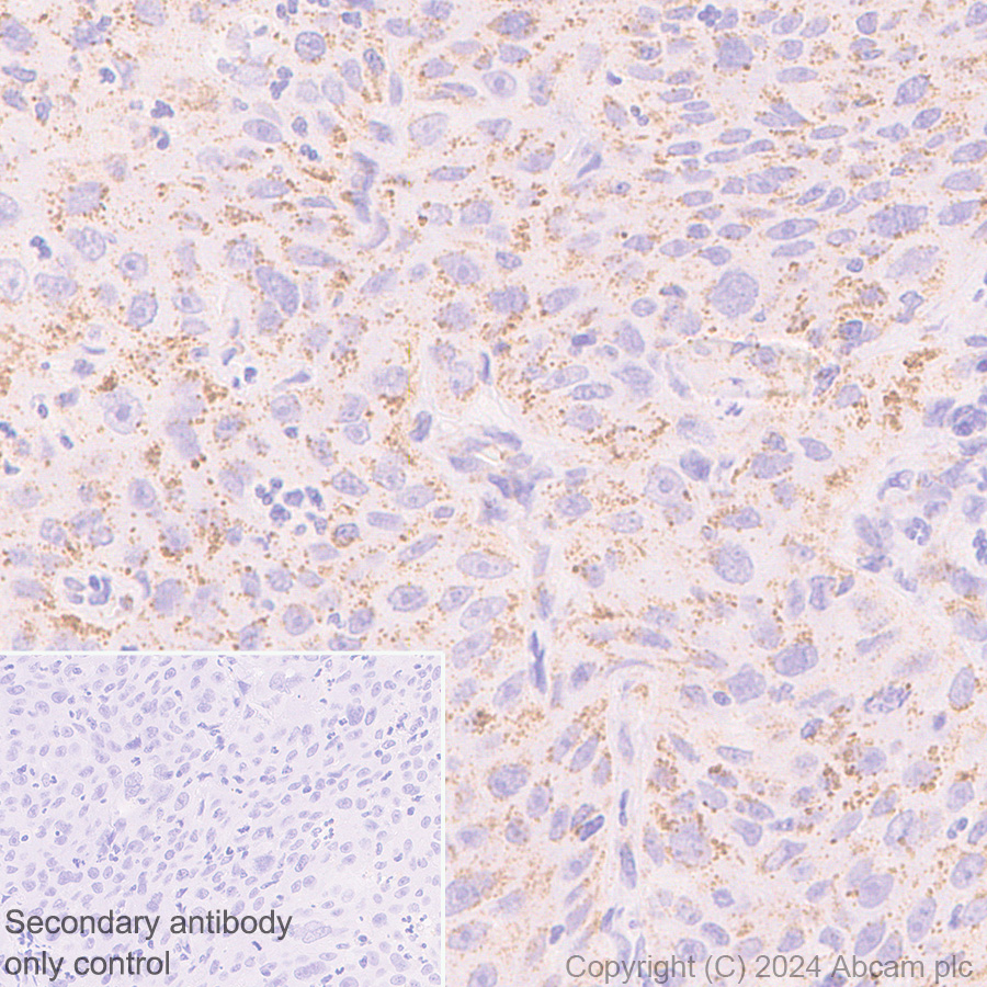 Immunohistochemistry (Formalin/PFA-fixed paraffin-embedded sections) - Rabbit specific IHC polymer detection kit HRP/DAB (ab209101), expandable thumbnail