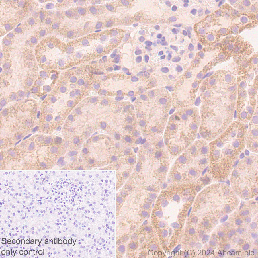 Immunohistochemistry (Formalin/PFA-fixed paraffin-embedded sections) - Rabbit specific IHC polymer detection kit HRP/DAB (ab209101), expandable thumbnail