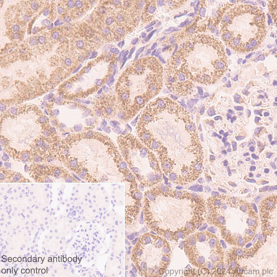 Immunohistochemistry (Formalin/PFA-fixed paraffin-embedded sections) - Rabbit specific IHC polymer detection kit HRP/DAB (ab209101), expandable thumbnail