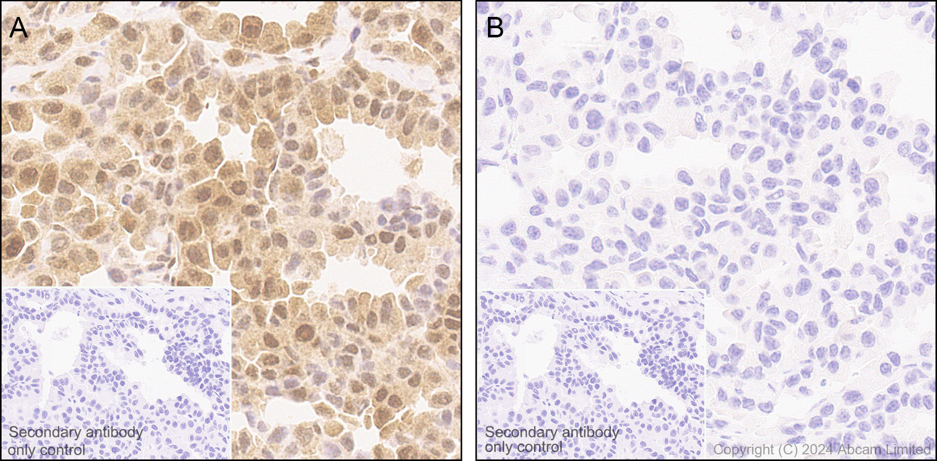 Immunohistochemistry (Formalin/PFA-fixed paraffin-embedded sections) - Rabbit specific IHC polymer detection kit HRP/DAB (ab209101), expandable thumbnail