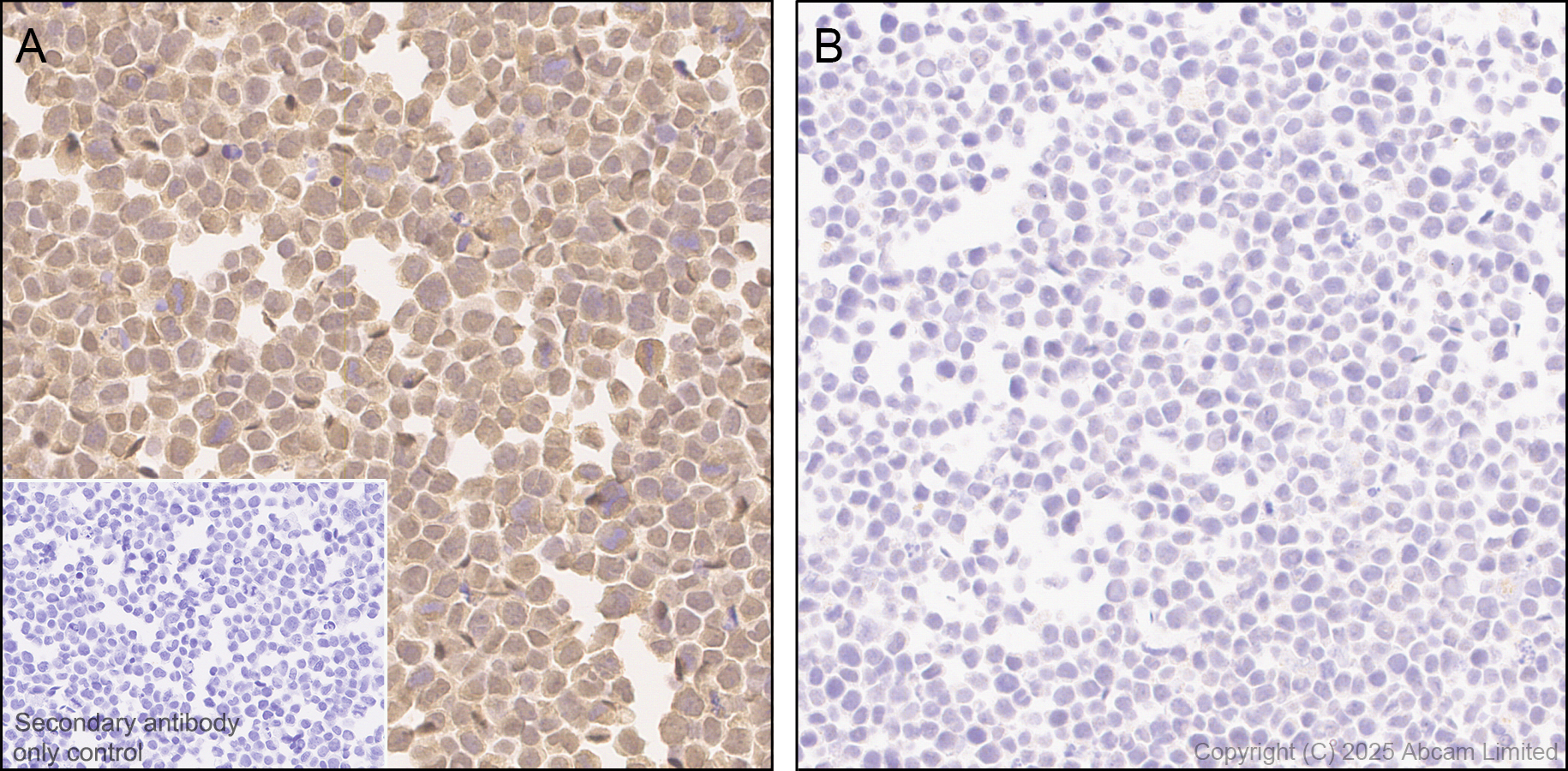 Immunohistochemistry (Formalin/PFA-fixed paraffin-embedded sections) - Rabbit specific IHC polymer detection kit HRP/DAB (ab209101), expandable thumbnail