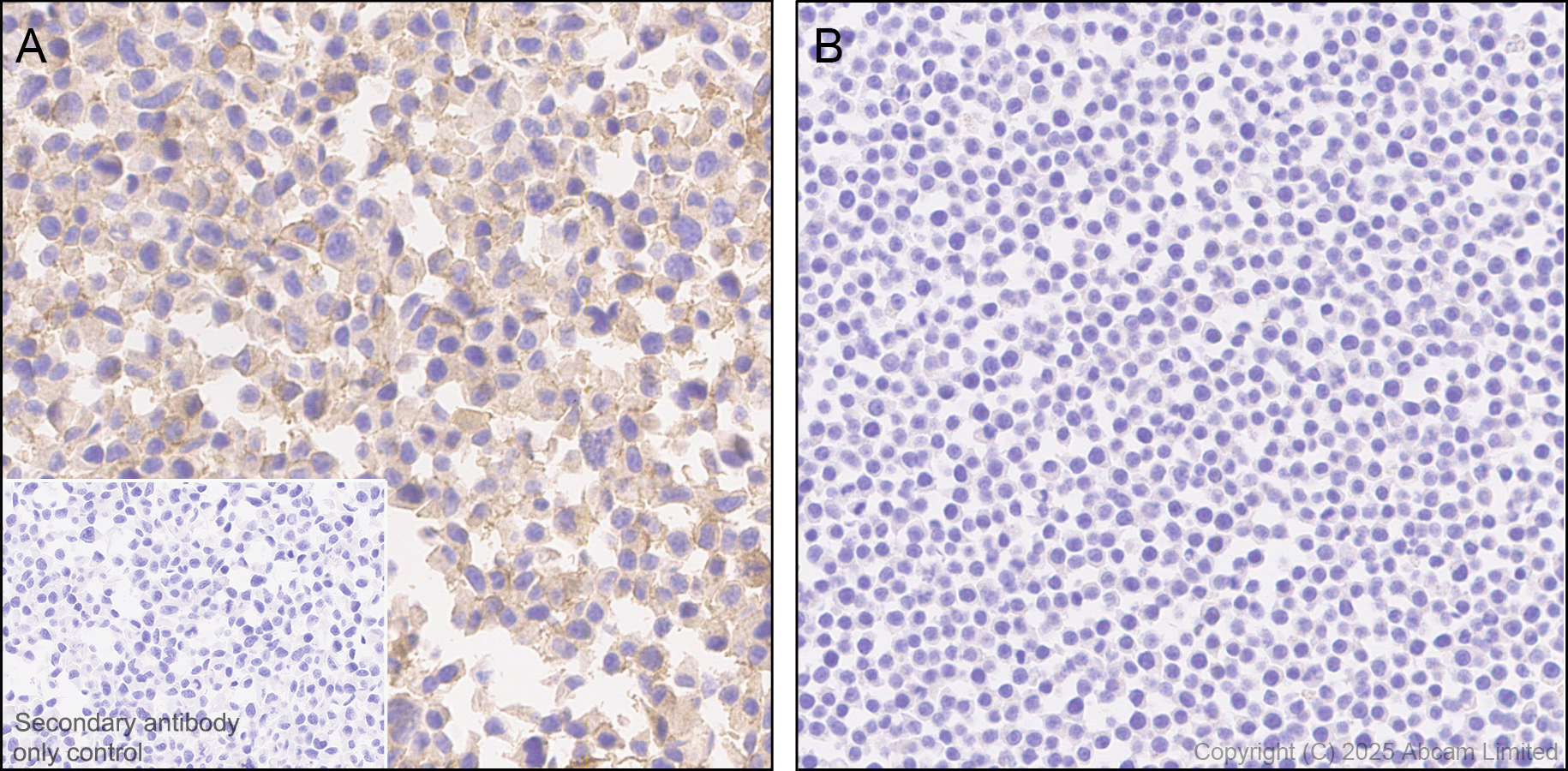 Immunohistochemistry (Formalin/PFA-fixed paraffin-embedded sections) - Rabbit specific IHC polymer detection kit HRP/DAB (ab209101), expandable thumbnail