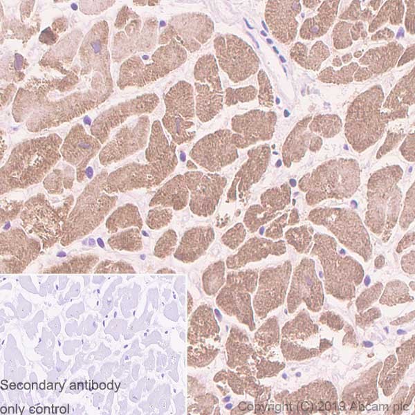 Immunohistochemistry (Formalin/PFA-fixed paraffin-embedded sections) - Rabbit specific IHC polymer detection kit HRP/DAB (ab209101), expandable thumbnail