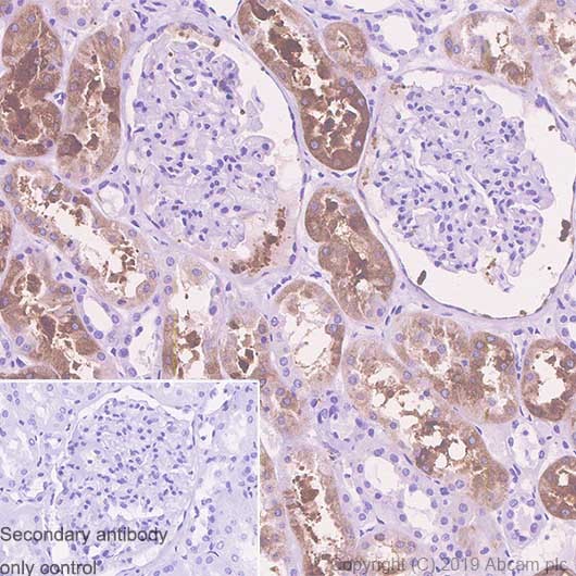 Immunohistochemistry (Formalin/PFA-fixed paraffin-embedded sections) - Rabbit specific IHC polymer detection kit HRP/DAB (ab209101), expandable thumbnail