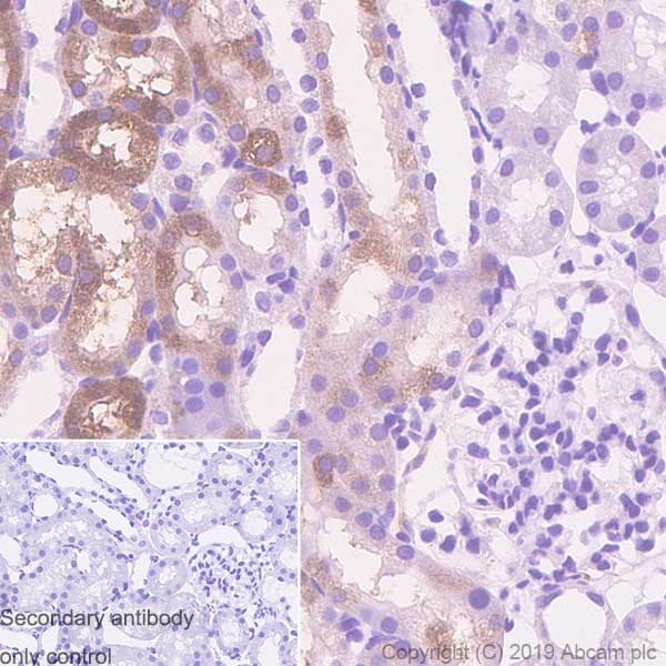 Immunohistochemistry (Formalin/PFA-fixed paraffin-embedded sections) - Rabbit specific IHC polymer detection kit HRP/DAB (ab209101), expandable thumbnail