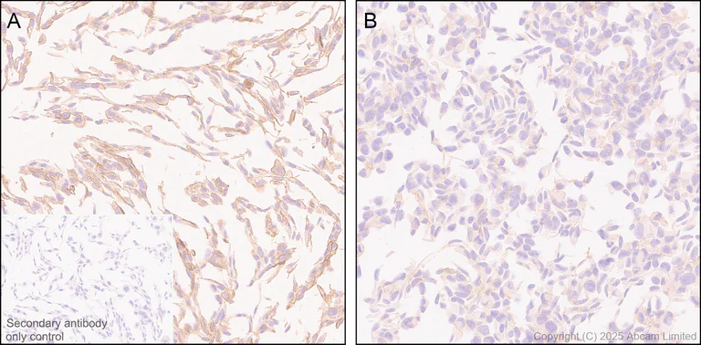 Immunohistochemistry (Formalin/PFA-fixed paraffin-embedded sections) - Rabbit specific IHC polymer detection kit HRP/DAB (AB209101)