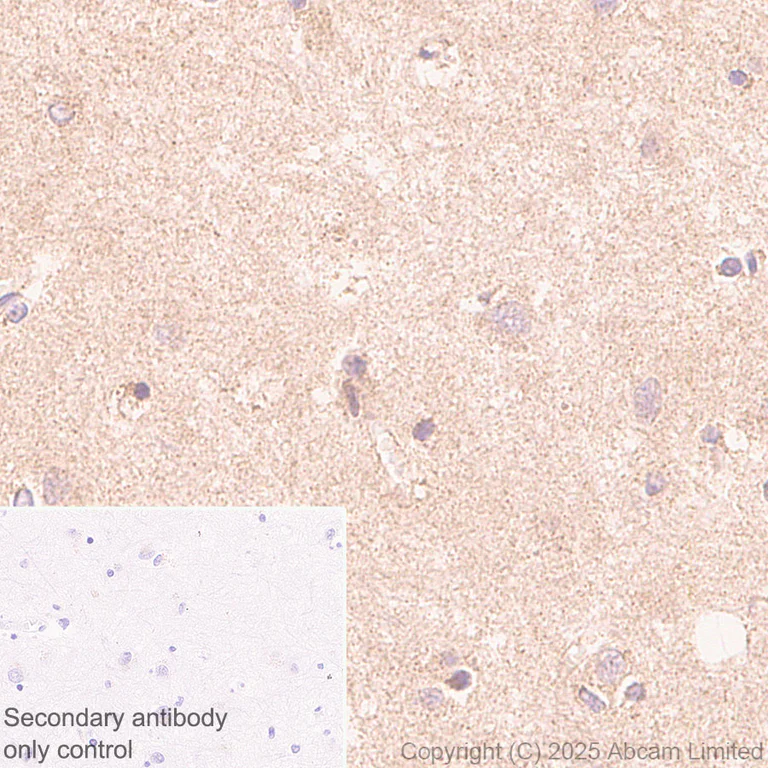 Immunohistochemistry (Formalin/PFA-fixed paraffin-embedded sections) - Rabbit specific IHC polymer detection kit HRP/DAB (AB209101)