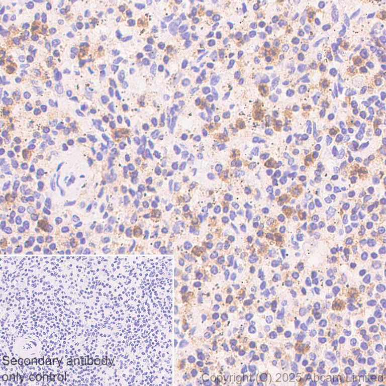 Immunohistochemistry (Formalin/PFA-fixed paraffin-embedded sections) - Rabbit specific IHC polymer detection kit HRP/DAB (AB209101)
