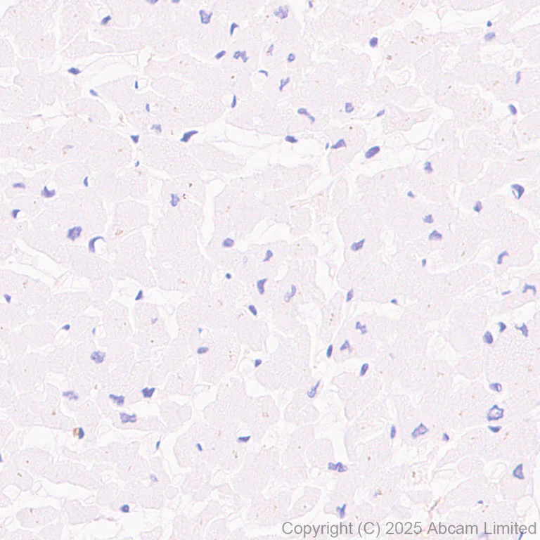 Immunohistochemistry (Formalin/PFA-fixed paraffin-embedded sections) - Rabbit specific IHC polymer detection kit HRP/DAB (AB209101)