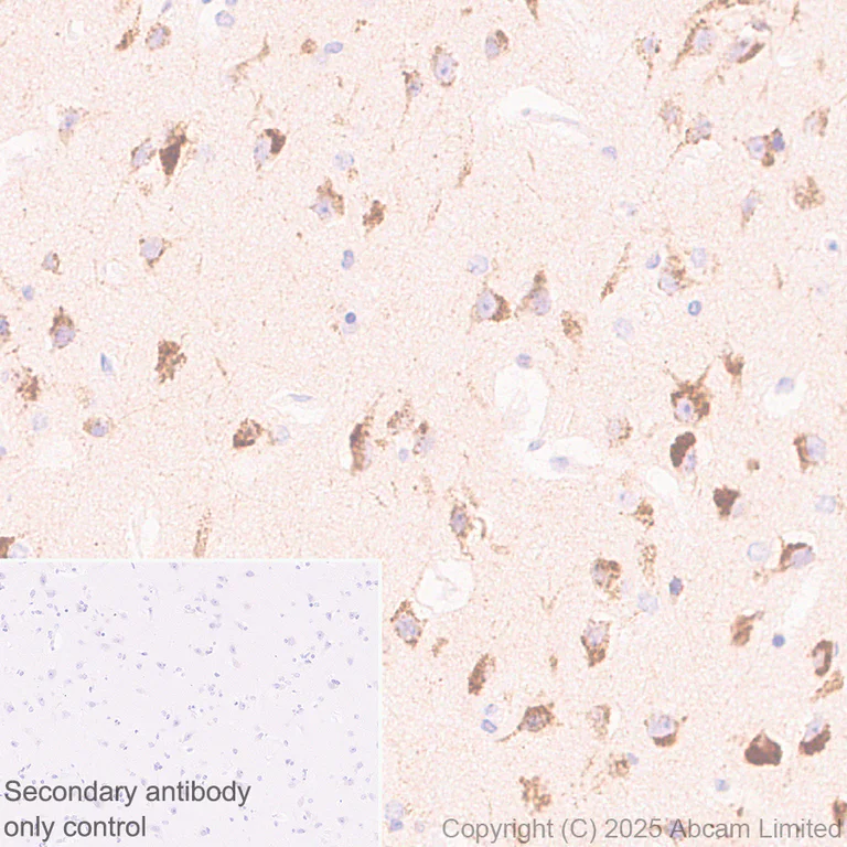 Immunohistochemistry (Formalin/PFA-fixed paraffin-embedded sections) - Rabbit specific IHC polymer detection kit HRP/DAB (AB209101)