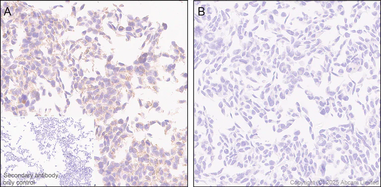 Immunohistochemistry (Formalin/PFA-fixed paraffin-embedded sections) - Rabbit specific IHC polymer detection kit HRP/DAB (AB209101)