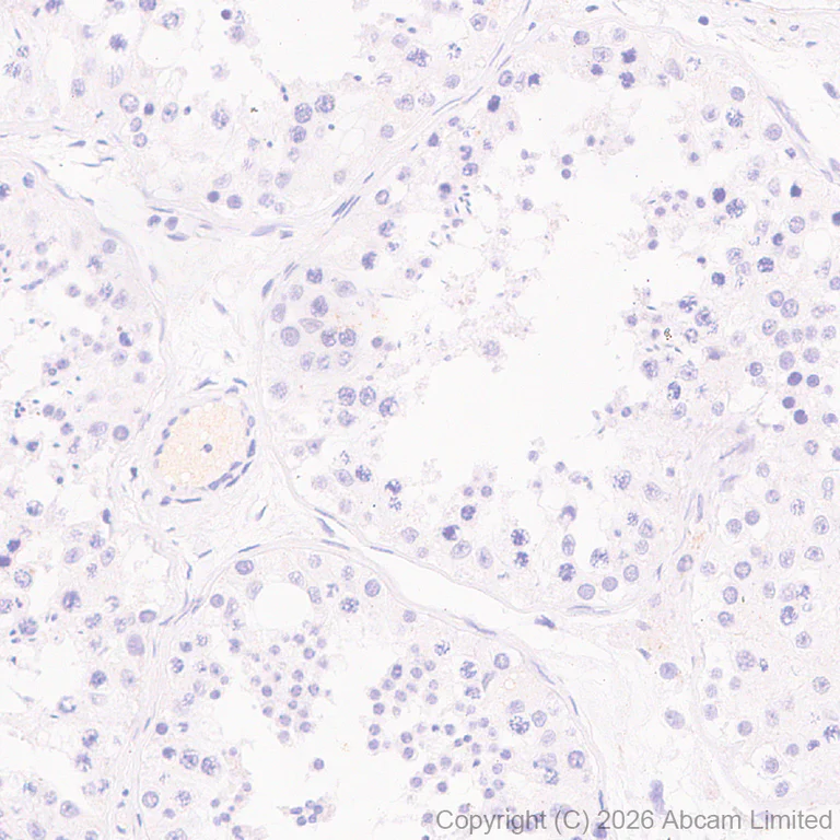 Immunohistochemistry (Formalin/PFA-fixed paraffin-embedded sections) - Rabbit specific IHC polymer detection kit HRP/DAB (AB209101)
