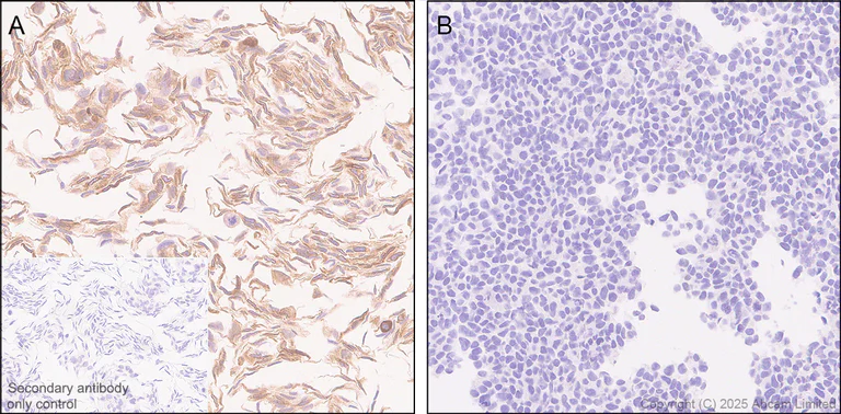 Immunohistochemistry (Formalin/PFA-fixed paraffin-embedded sections) - Rabbit specific IHC polymer detection kit HRP/DAB (AB209101)
