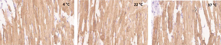 Immunohistochemistry (Formalin/PFA-fixed paraffin-embedded sections) - Rabbit specific IHC polymer detection kit HRP/DAB (AB209101)
