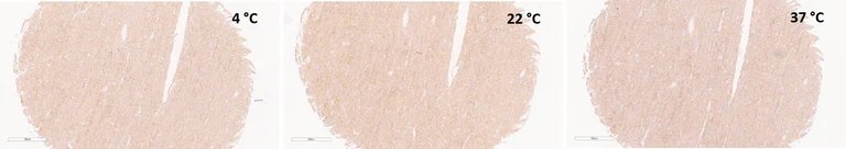 Immunohistochemistry (Formalin/PFA-fixed paraffin-embedded sections) - Rabbit specific IHC polymer detection kit HRP/DAB (AB209101)