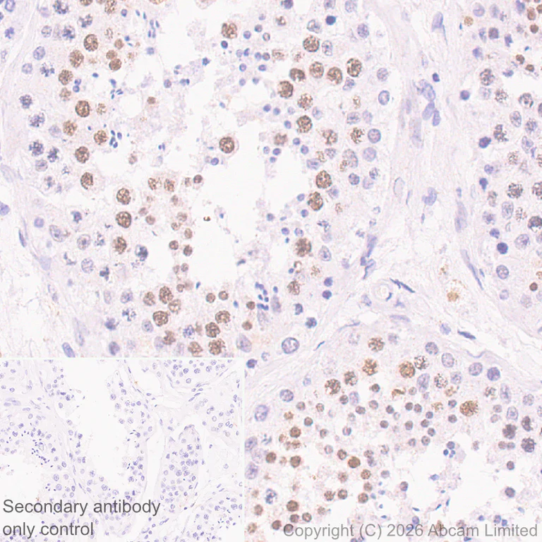 Immunohistochemistry (Formalin/PFA-fixed paraffin-embedded sections) - Rabbit specific IHC polymer detection kit HRP/DAB (AB209101)