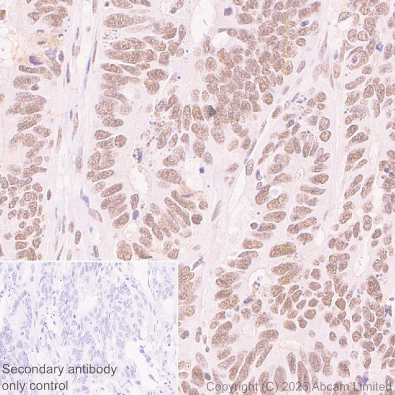 Immunohistochemistry (Formalin/PFA-fixed paraffin-embedded sections) - Rabbit specific IHC polymer detection kit HRP/DAB (AB209101)