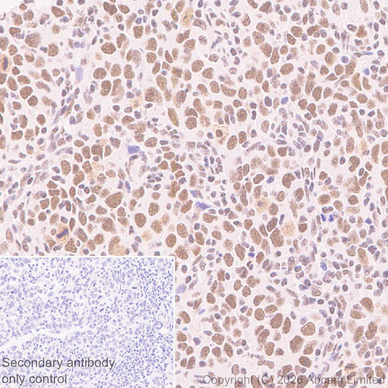 Immunohistochemistry (Formalin/PFA-fixed paraffin-embedded sections) - Rabbit specific IHC polymer detection kit HRP/DAB (AB209101)