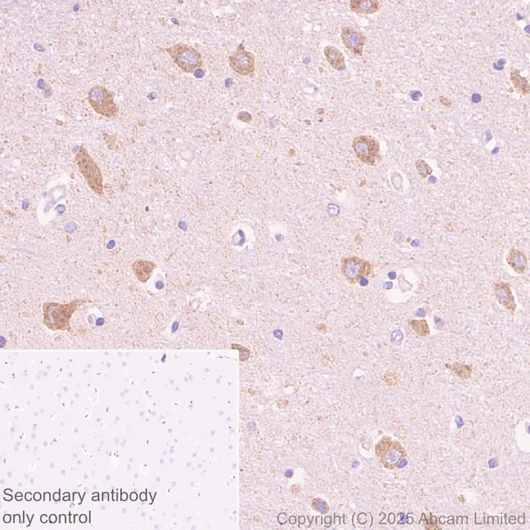 Immunohistochemistry (Formalin/PFA-fixed paraffin-embedded sections) - Rabbit specific IHC polymer detection kit HRP/DAB (AB209101)