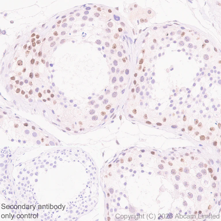 Immunohistochemistry (Formalin/PFA-fixed paraffin-embedded sections) - Rabbit specific IHC polymer detection kit HRP/DAB (AB209101)