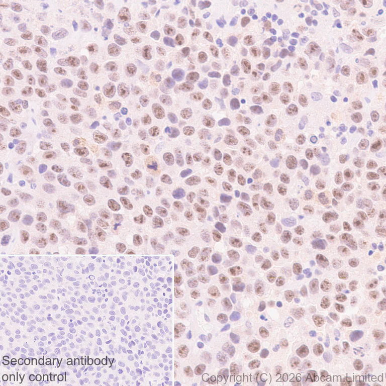 Immunohistochemistry (Formalin/PFA-fixed paraffin-embedded sections) - Rabbit specific IHC polymer detection kit HRP/DAB (AB209101)