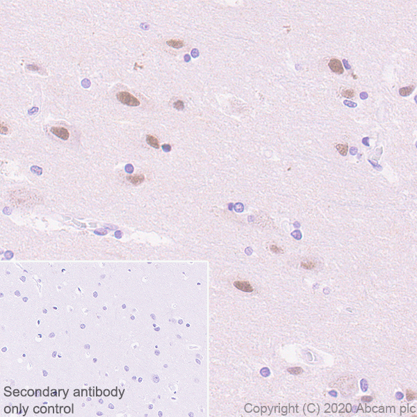 Immunohistochemistry (Formalin/PFA-fixed paraffin-embedded sections) - Rabbit specific IHC polymer detection kit HRP/DAB (AB209101), expandable thumbnail