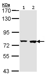 Western blot - Anti-Rabenosyn 5 antibody - C-terminal (AB155247), expandable thumbnail