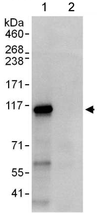 Immunoprecipitation - Anti-RABEP1 antibody (AB176578), expandable thumbnail