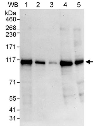 Western blot - Anti-RABEP1 antibody (AB176578), expandable thumbnail