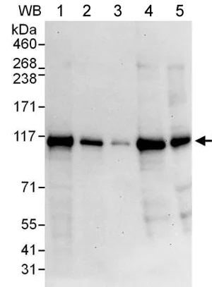 Western blot - Anti-RABEP1 antibody (AB176578)