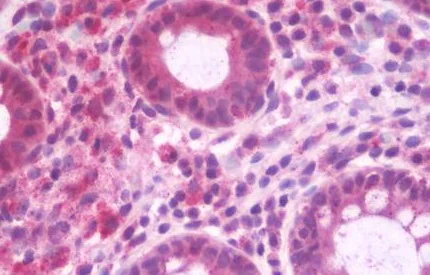 Immunohistochemistry (Formalin/PFA-fixed paraffin-embedded sections) - Anti-RABEP2 antibody (AB190003)