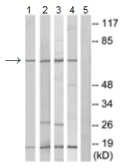Western blot - Anti-RABEP2 antibody (AB190003)