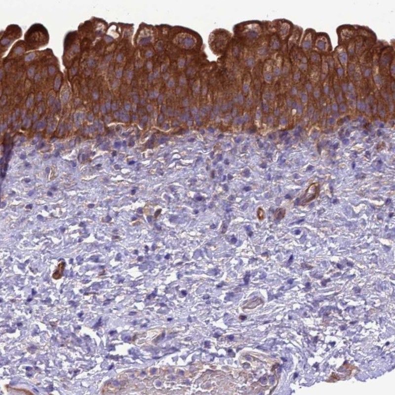 Immunohistochemistry (Formalin/PFA-fixed paraffin-embedded sections) - Anti-RABEP2 antibody (AB254907)