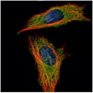 Immunocytochemistry/ Immunofluorescence - Anti-RABGAP1 antibody - C-terminal (AB153992), expandable thumbnail