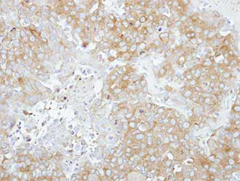 Immunohistochemistry (Formalin/PFA-fixed paraffin-embedded sections) - Anti-RABGAP1 antibody - C-terminal (AB153992)
