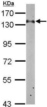 Western blot - Anti-RABGAP1 antibody - C-terminal (AB153992)