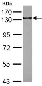 Western blot - Anti-RABGAP1 antibody - C-terminal (AB153992)