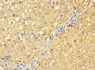 Immunohistochemistry (Formalin/PFA-fixed paraffin-embedded sections) - Anti-RABGAP1L/HHL antibody (AB229956), expandable thumbnail