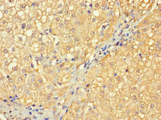 Immunohistochemistry (Formalin/PFA-fixed paraffin-embedded sections) - Anti-RABGAP1L/HHL antibody (AB229956)
