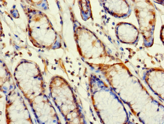 Immunohistochemistry (Formalin/PFA-fixed paraffin-embedded sections) - Anti-RABGAP1L/HHL antibody (AB229956), expandable thumbnail