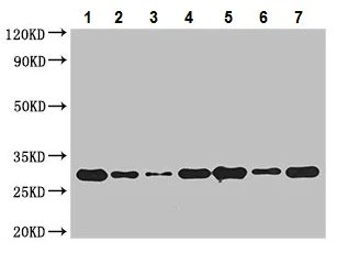 Western blot - Anti-RABGAP1L/HHL antibody (AB229956)