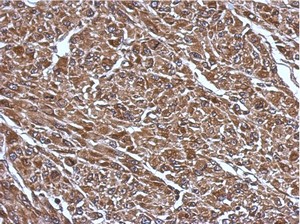 Immunohistochemistry (Formalin/PFA-fixed paraffin-embedded sections) - Anti-RABGGTB antibody (AB154702)