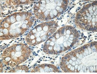Immunohistochemistry (Formalin/PFA-fixed paraffin-embedded sections) - Anti-RABIF antibody (AB205029)