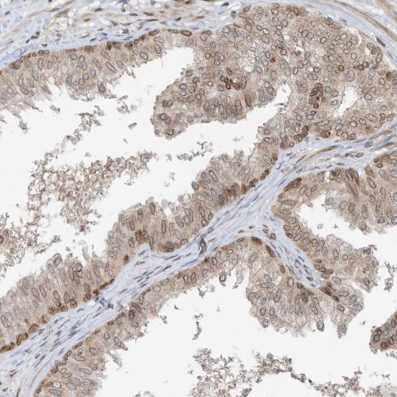 Immunohistochemistry (Formalin/PFA-fixed paraffin-embedded sections) - Anti-RABL3 antibody (AB122257)