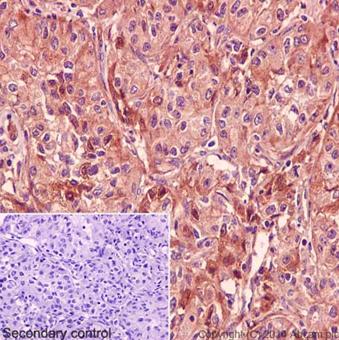 Immunohistochemistry (Formalin/PFA-fixed paraffin-embedded sections) - Anti-RABL3 antibody [EPR16709] - C-terminal (AB196024)