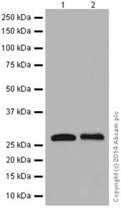 Western blot - Anti-RABL3 antibody [EPR16709] - C-terminal (AB196024)