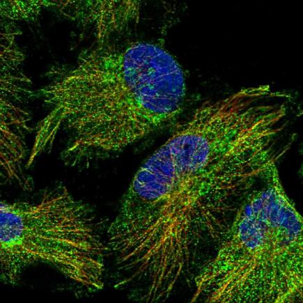 Immunocytochemistry/ Immunofluorescence - Anti-RABL5 antibody (AB243807)
